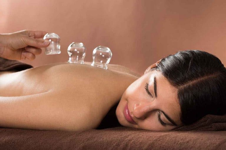 Woman lying on her stomach undergoing cupping therapy