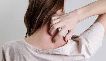 Woman scratching the back of her neck
