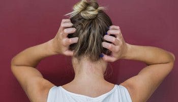 Woman scratching the back of her scalp