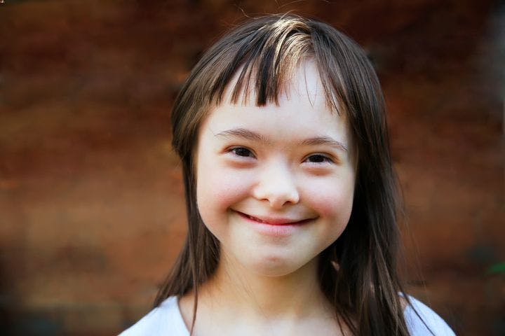 Girl with Down’s syndrome smiling gleefully