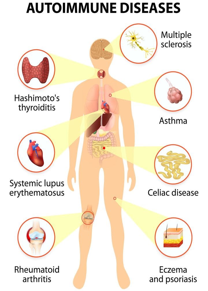 Illustration showing tissues of the human body affected by autoimmune disease
