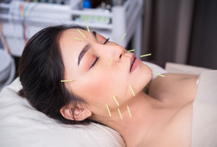 Woman resting, with painless acupuncture on her face