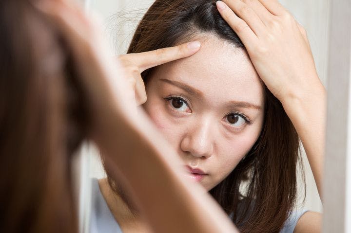 A young Asian girl checking for bald patch on her scalp