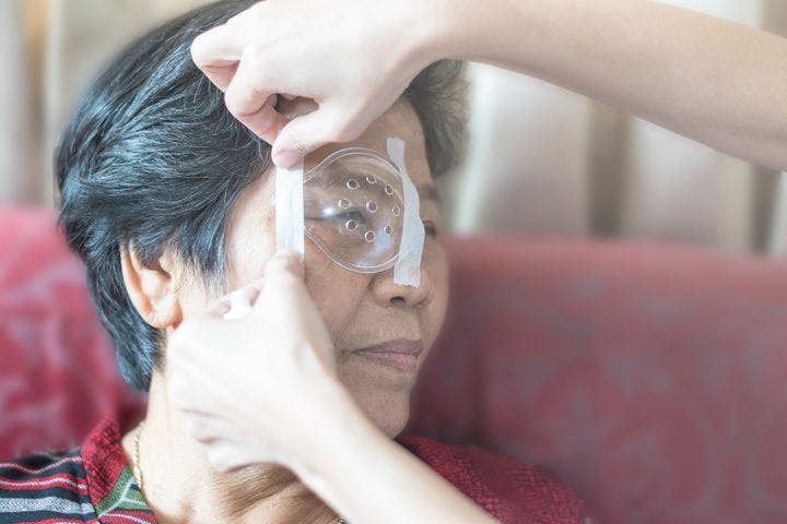 Woman taping a plastic shield on top of a woman’s right eye