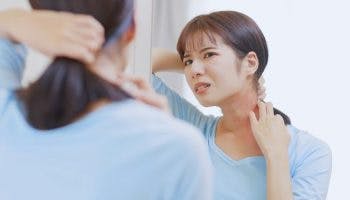 A woman checking red rashes on her neck in the mirror