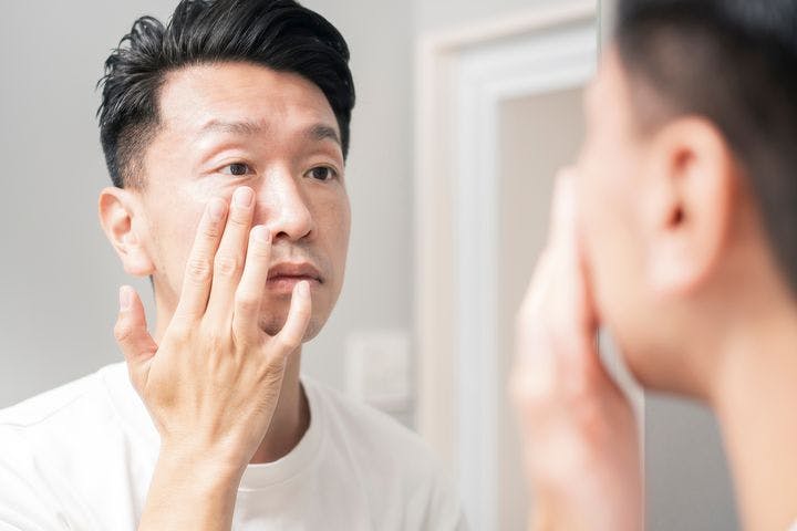 A man touching his face, checking if he has Ramsay Hunt Syndrome 