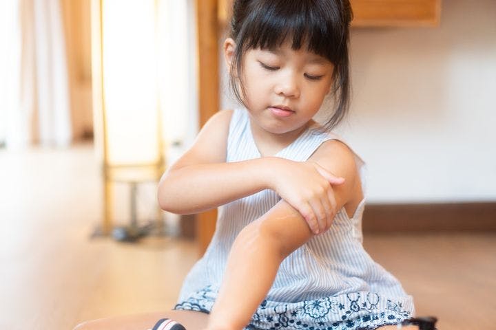 A young girl scratching her itchy skin due to food allergy symptoms