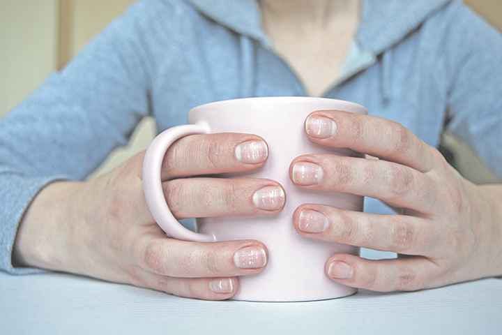 Close-up of multiple white spots and bands on a woman’s fingernails as she holds a white mug with both hands.
