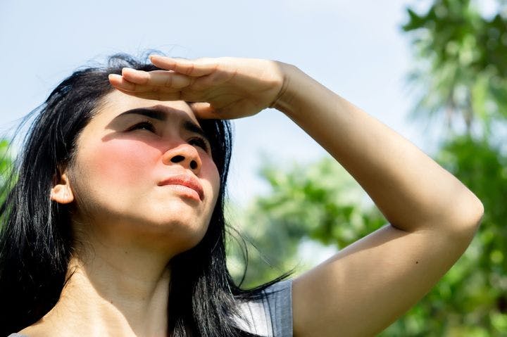 Woman standing outdoors under the sun with sunburnt cheeks covering her eyes with her left hand as she looks up