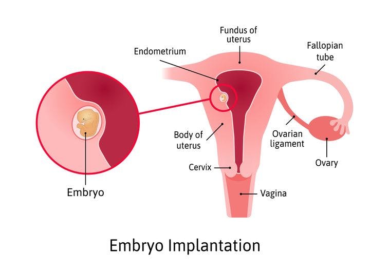 Illustration of human embryo attaching itself to the endometrium.
