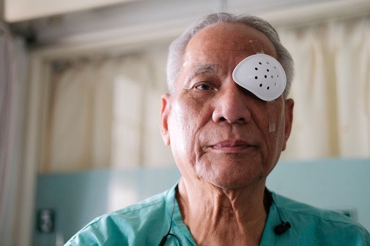 Close-up of a man’s face with his left eye covered by a plastic shield after cataract surgery. 