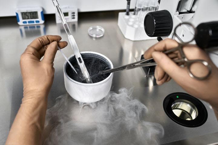 Close-up of a healthcare worker using a pair of clamping scissors to extract material from a cryogenic storage container in a laboratory.