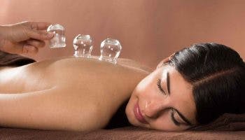Woman lying on her stomach undergoing cupping therapy