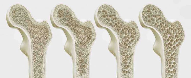 Four bones arranged in order of increasing porosity from left to right