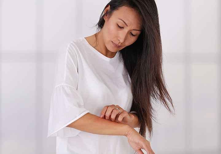 Women in white shirt scratches food allergy rash on arm