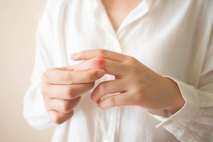 A woman feeling her fingers due to joint pain