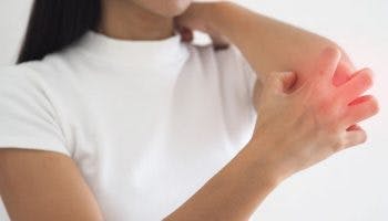 Woman scratching her left elbow