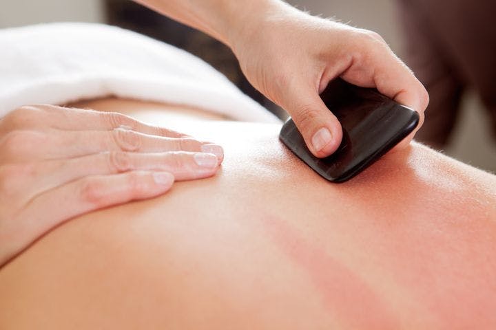 Large bone scraper tool being used during a gua sha acupuncture treatment 