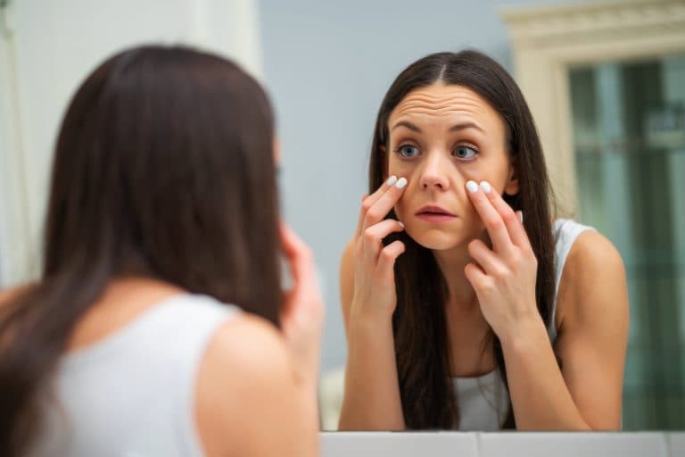 Eye bags min scaled