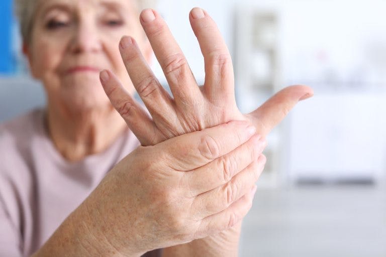 Rheumatoid arthritis is an autoimmune condition with no cure, but there are several ways to manage symptoms.