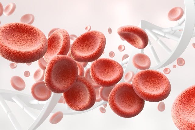 Iron deficiency anemia discover its symptoms and supplements to take