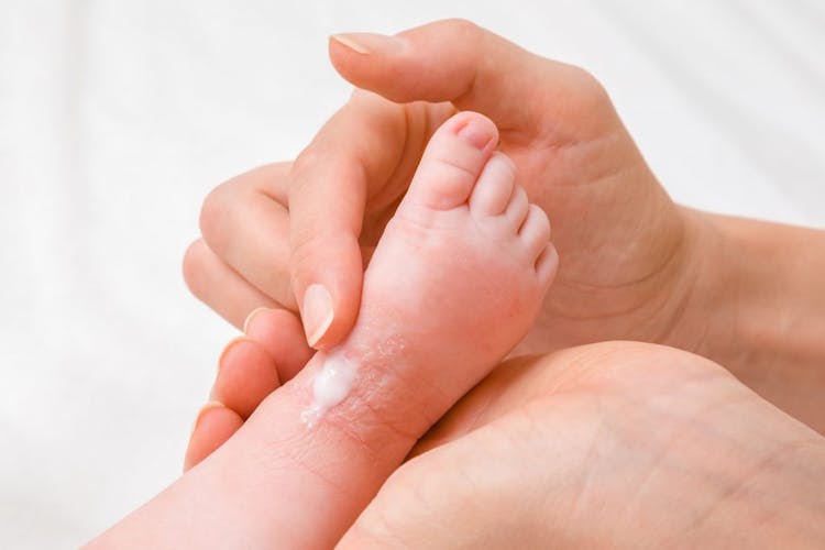 Image of a woman's hand applying lotion to a newborn baby's ankle