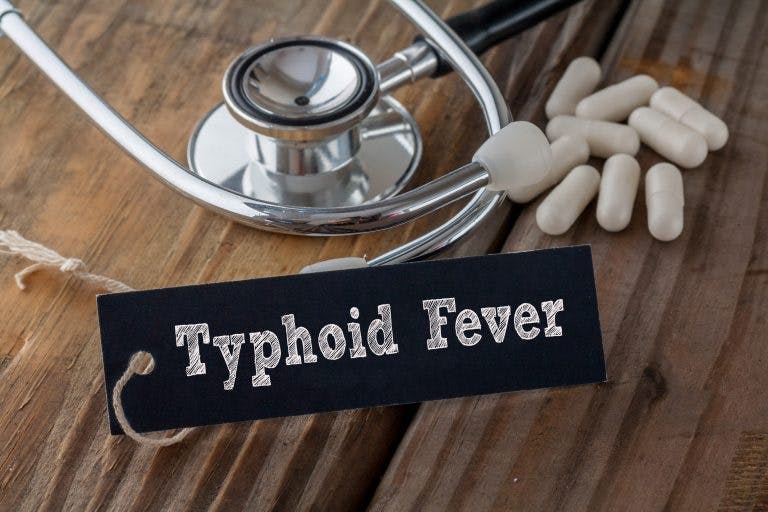 Typhoid fever min scaled