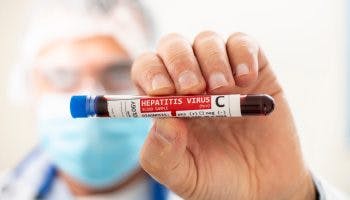 Hepatitis c virus min scaled