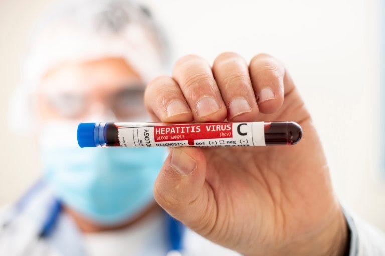 Hepatitis c virus min scaled