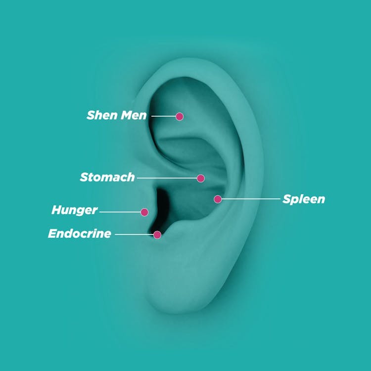 An illustration of an ear showing acupoints for weight management and reduction of LDL cholesterol