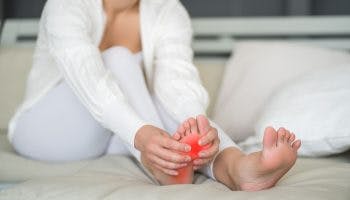 A woman sitting on a bed touching her painful foot due to plantar fasciitis