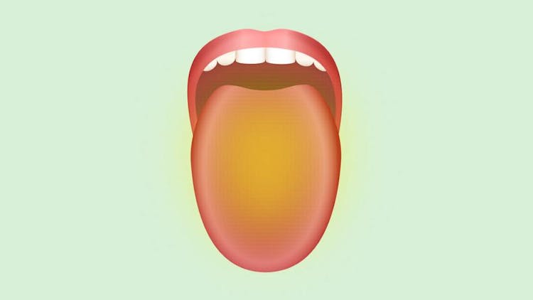 An illustration of yellow colored tongue