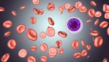 Iron deficiency anemia min scaled